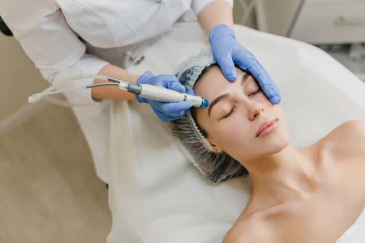 microdermoabrasión y dermaplaning